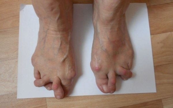 Категория годности 