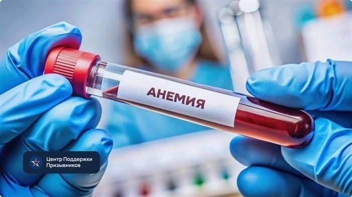 Можно ли служить в армии с анемией?