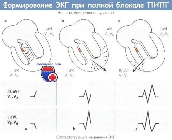 Диагностические мероприятия при блокаде правой ножки пучка Гиса