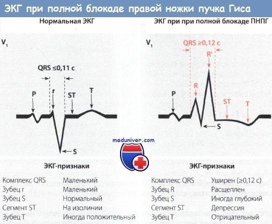Устройство кабеля ППГнгA-HF: что нужно знать
