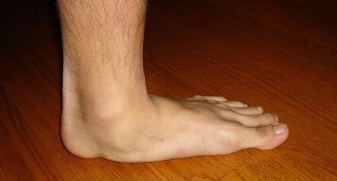 Какие заболевания могут стать препятствием для постановки на воинский учет?