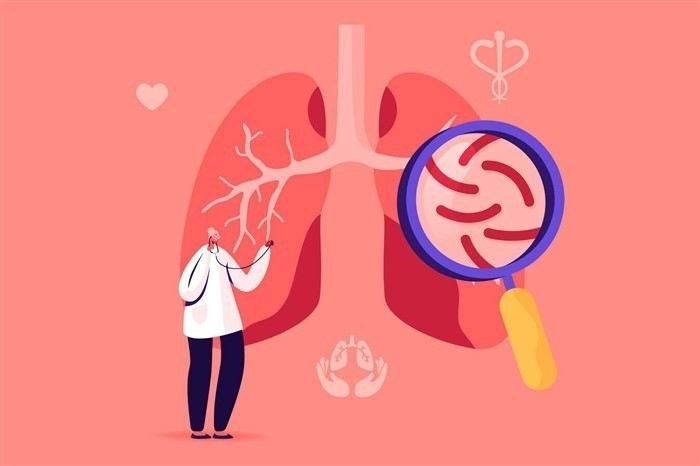 Как часто нужно делать флюорографию и кому она показана