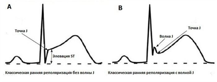 Какие льготы предоставляет служба по призыву в специальный стаж?